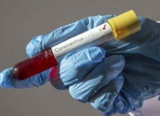 Guinée/Coronavirus : 17 personnes gueris et 233 hospitalisées